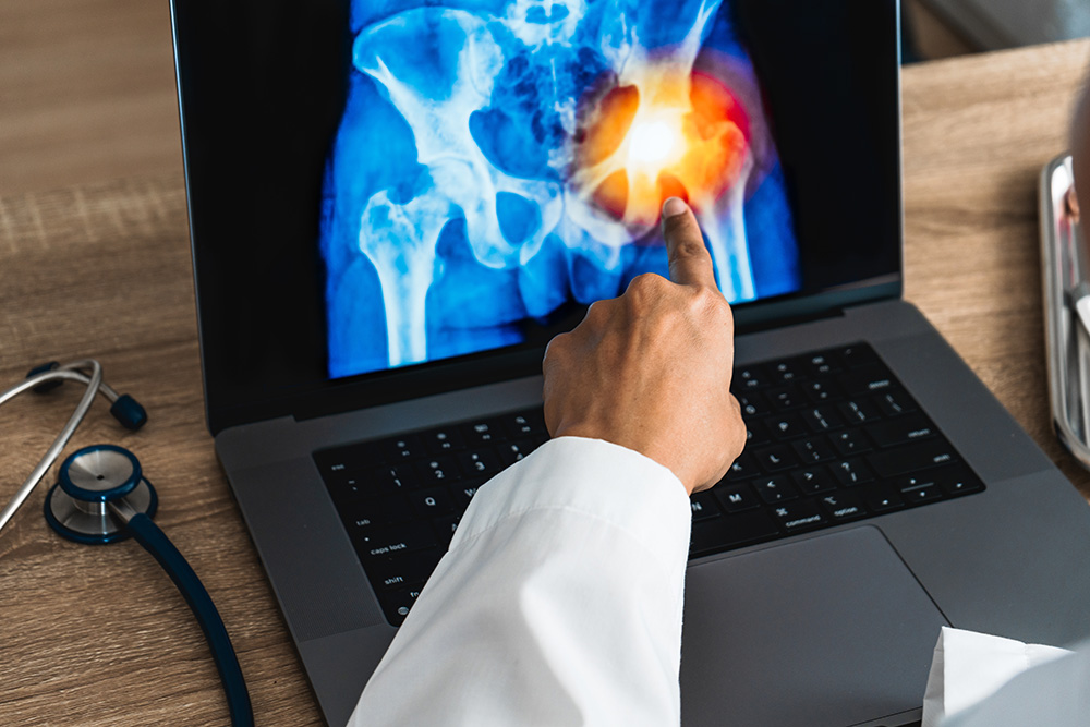 A doctor points at a highlighted area on a hip X-ray displayed on a laptop, possibly indicating an injury or problem. A stethoscope and documents are on the wooden desk nearby.