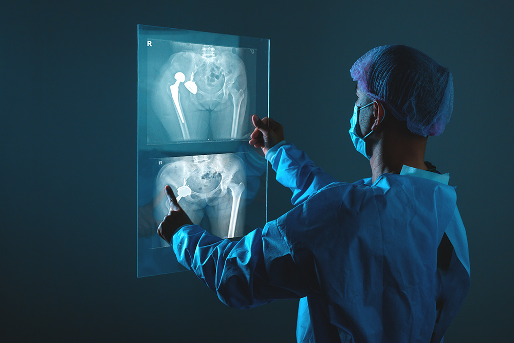 A doctor wearing surgical scrubs, a mask, and a hair cover examines hip joint X-ray images, one showing a hip replacement, in a dimly lit room.