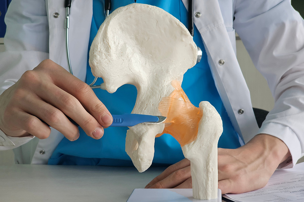 A doctor in a white coat points with a pen to the hip joint area on a human hip bone model, highlighting the joint in orange.