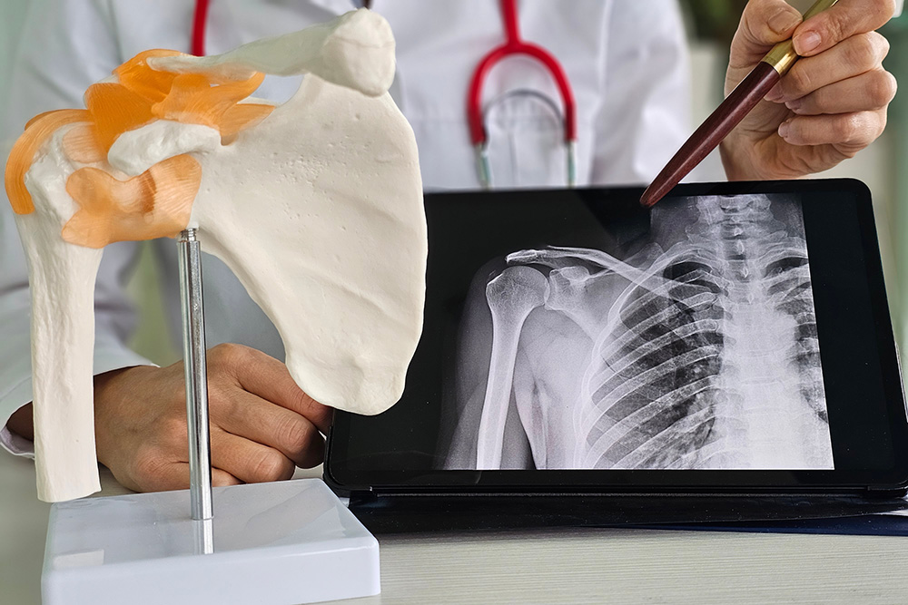 A doctor points with a pen at a shoulder X-ray displayed on a tablet, while a model of the shoulder joint sits nearby on a desk. The doctor wears a white coat and a red stethoscope.