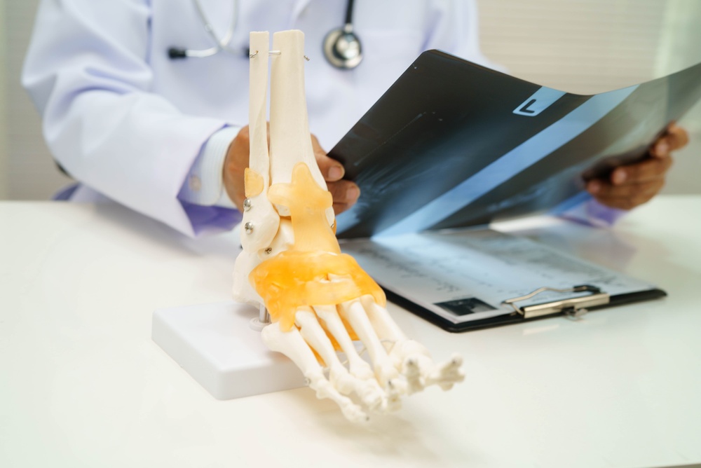 A doctor examines an X-ray next to a model of a human foot and ankle on a desk, with a clipboard and stethoscope visible.