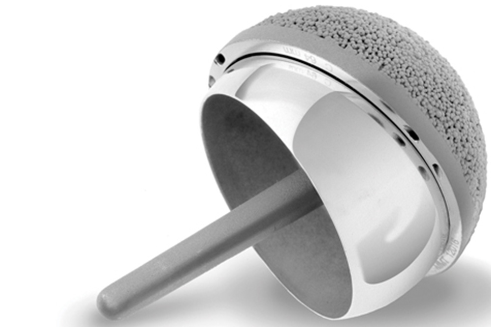 A close-up photo of a hip replacement implant, showing a metallic prosthetic ball with a textured surface and a smooth stem used in orthopedic surgery.